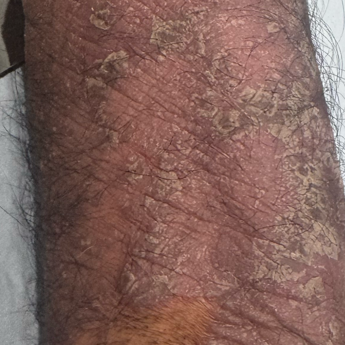 Dr.Valarma