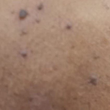 Vibha skin