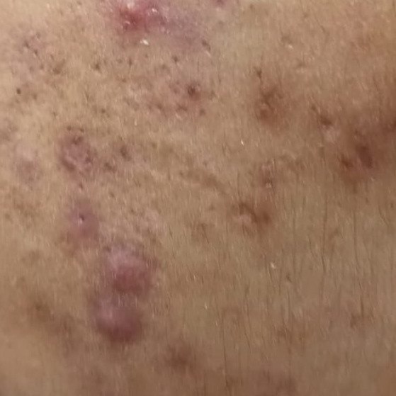 Vibha skin