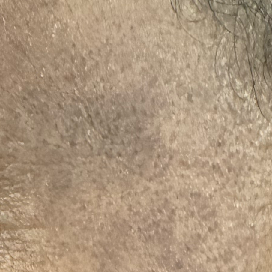 Vibha skin