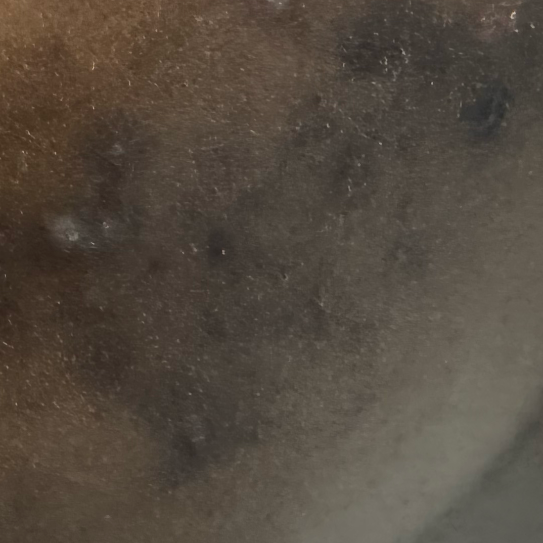 Vibha skin