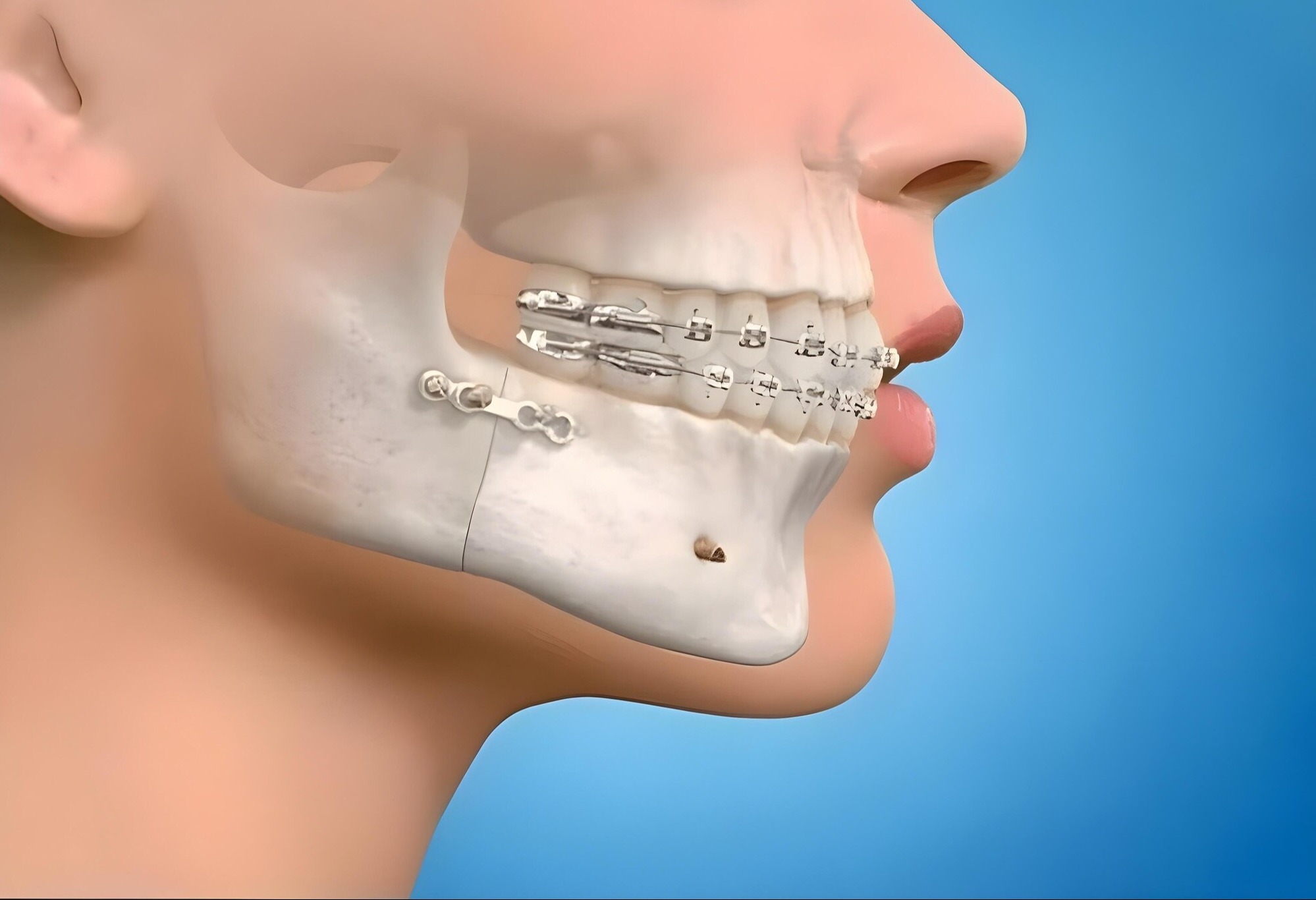 Maxillofacial Surgery in Pimpri – Specialized Care for Facial and Jaw Conditions main image