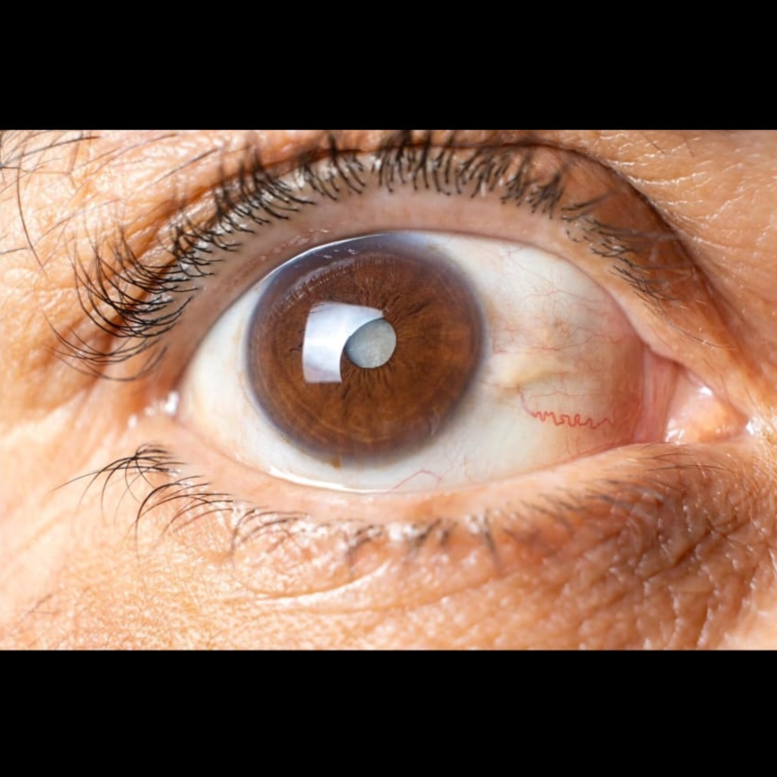 Best Eye Doctor Near Me In Salem Seelanaickenpatti main image