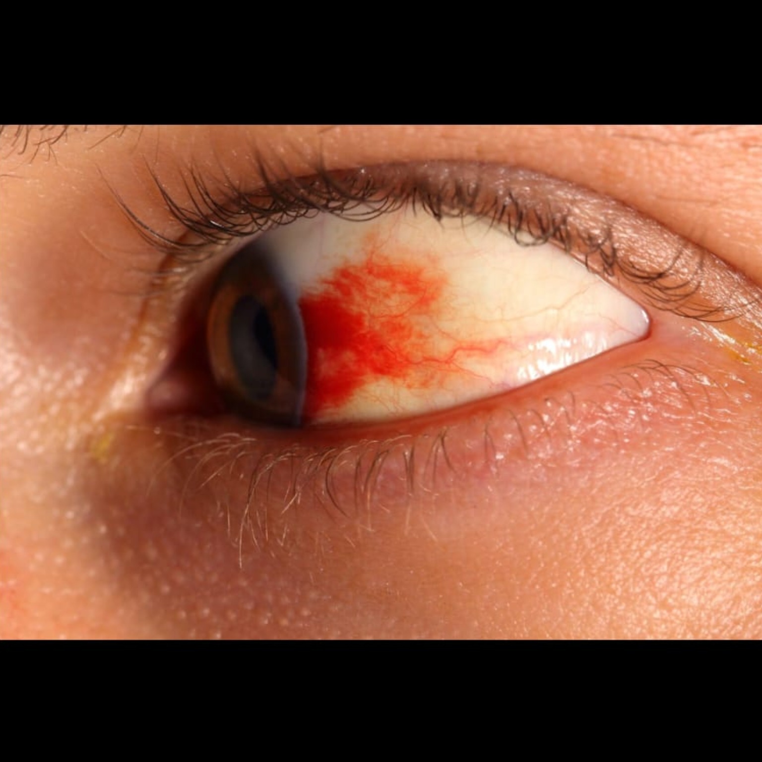 Best Eye Doctor Near Me In Salem  main image