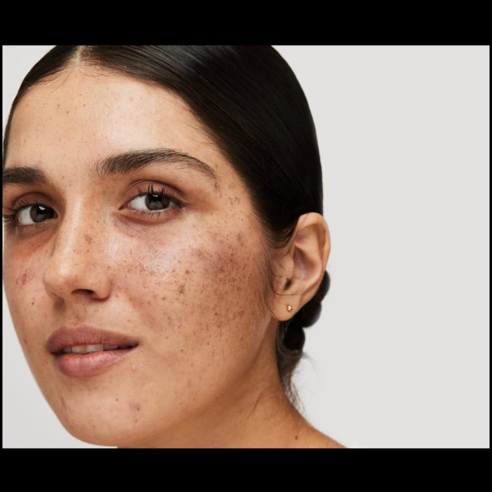 Skin Care Doctor Near Me In Salem Kondalampatti main image