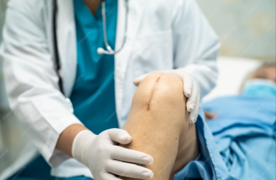 Joint Replacement for Both Knee Joint in Chennai – Restoring Everyday Movement main image