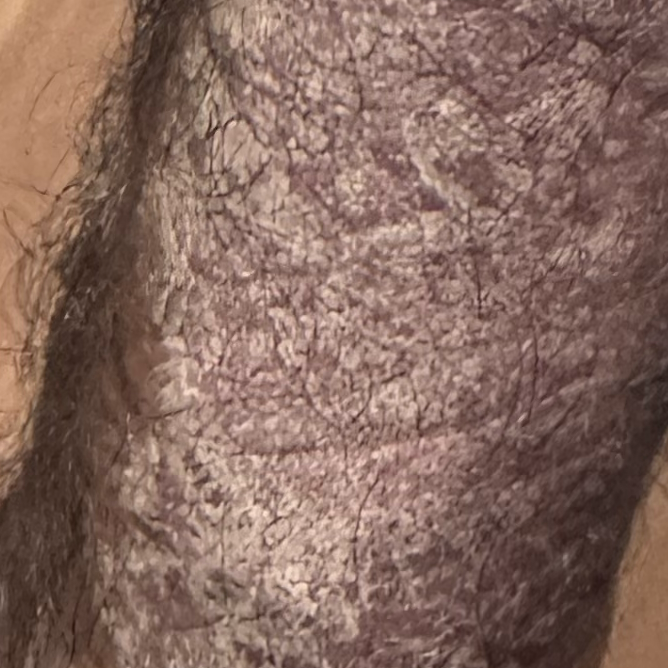 Dr.Valarma