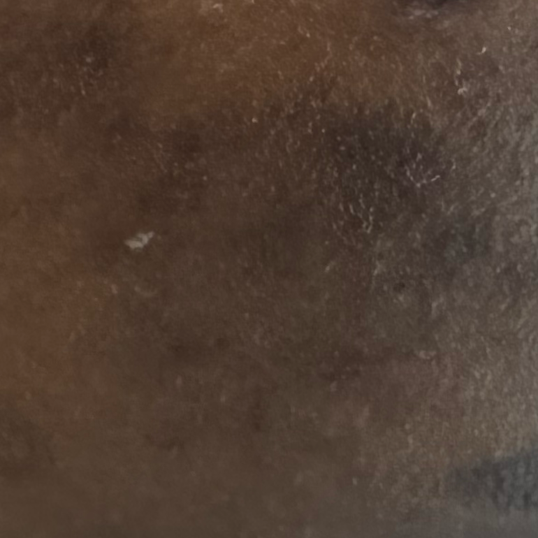 Vibha skin