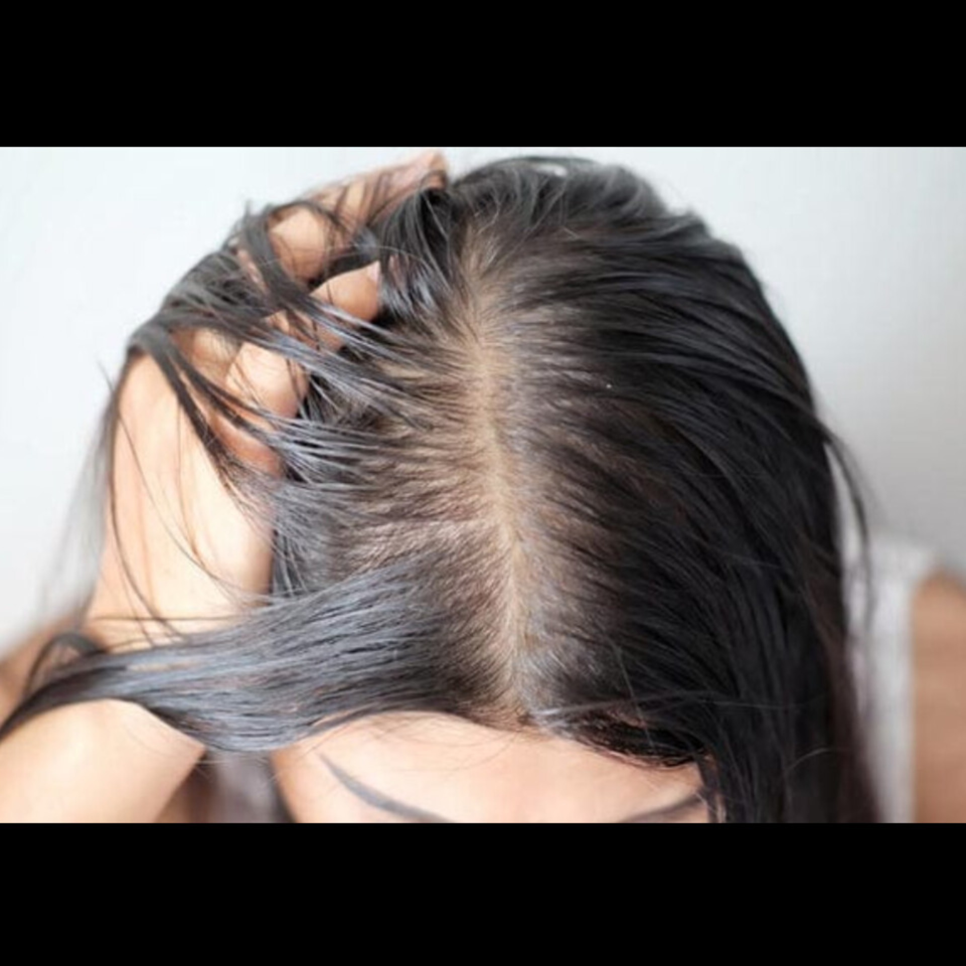 Hair Care Doctor Near Me In Salem Seelanaickenpatti main image