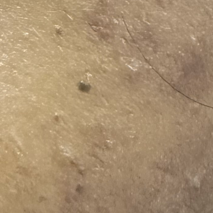 Vibha skin