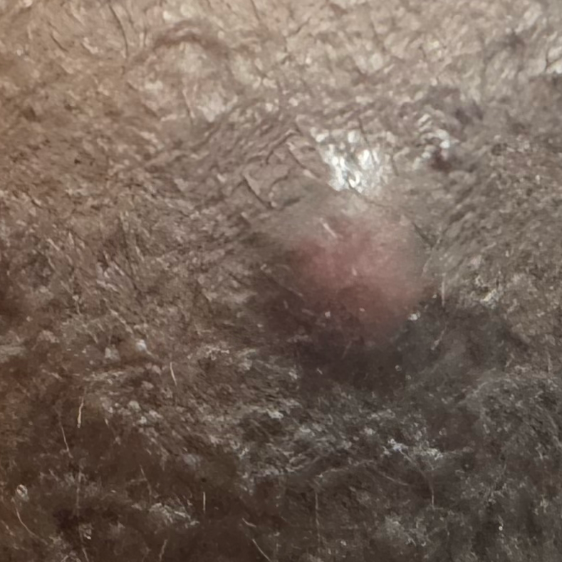 Vibha skin