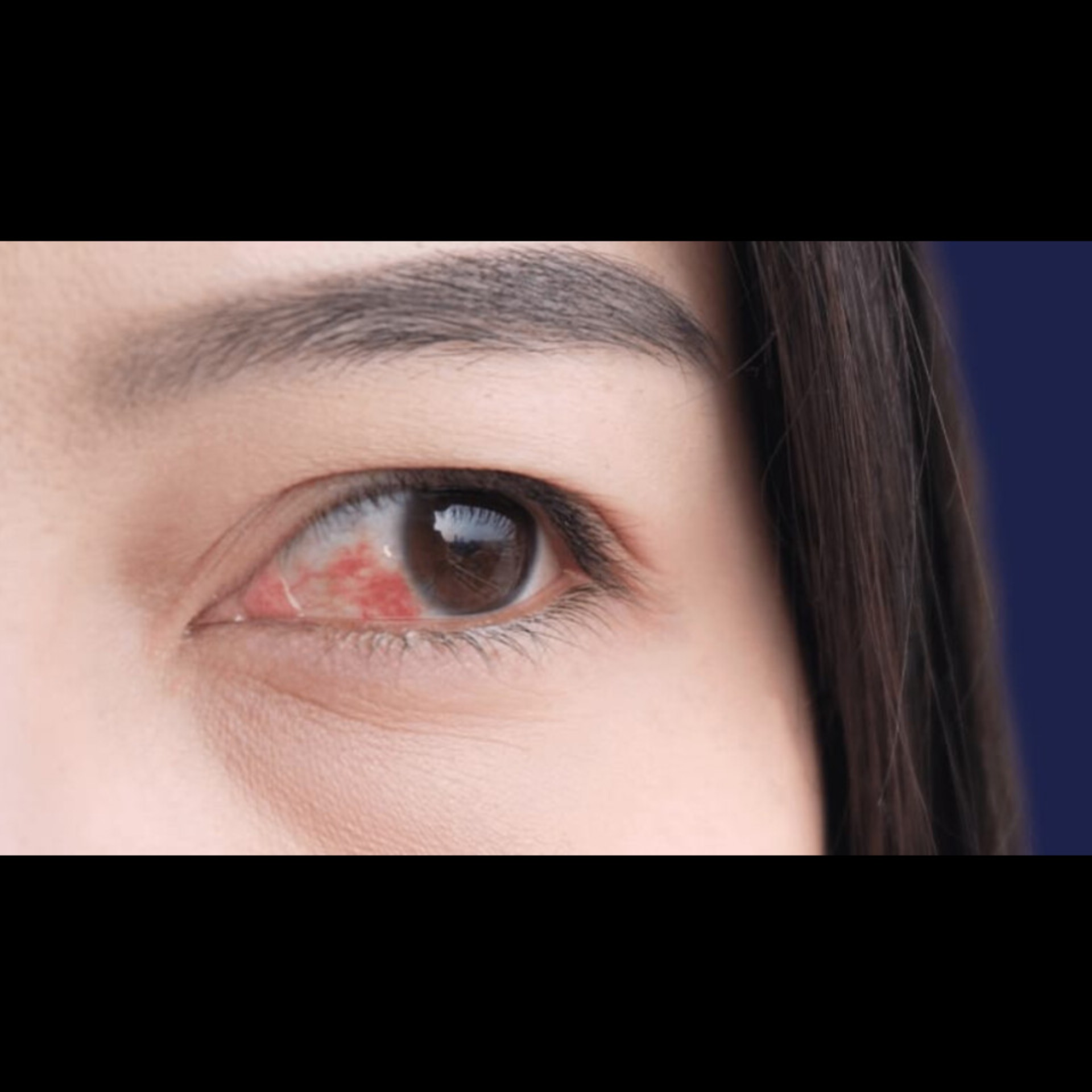 Eye Care Hospital Near Me In Salem main image