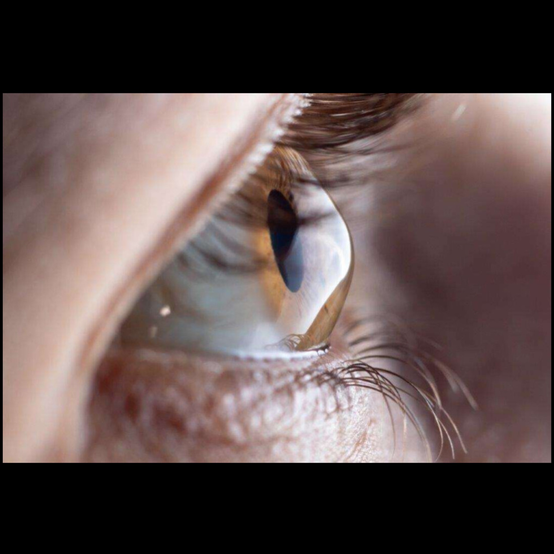 Eye Doctor Near Me In Salem Seelanaickenpatti  main image