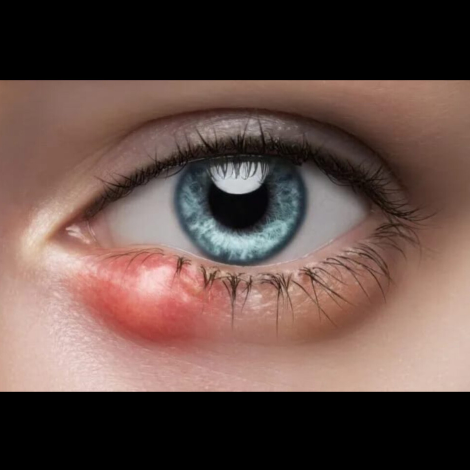 Best Eye Doctor Near Me In Salem main image
