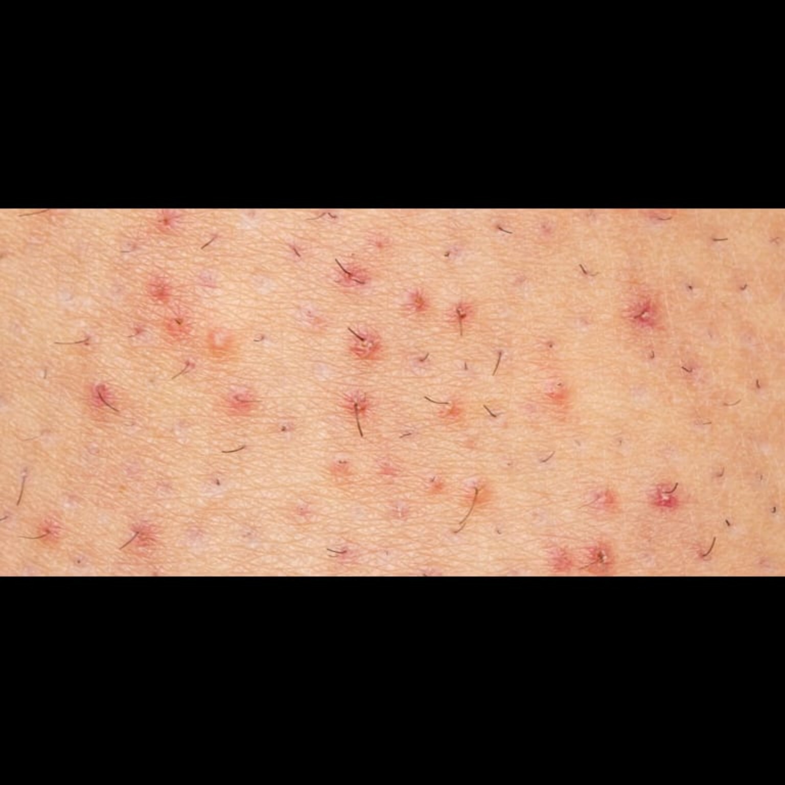 Hair Care Doctor Near Me In Salem  main image