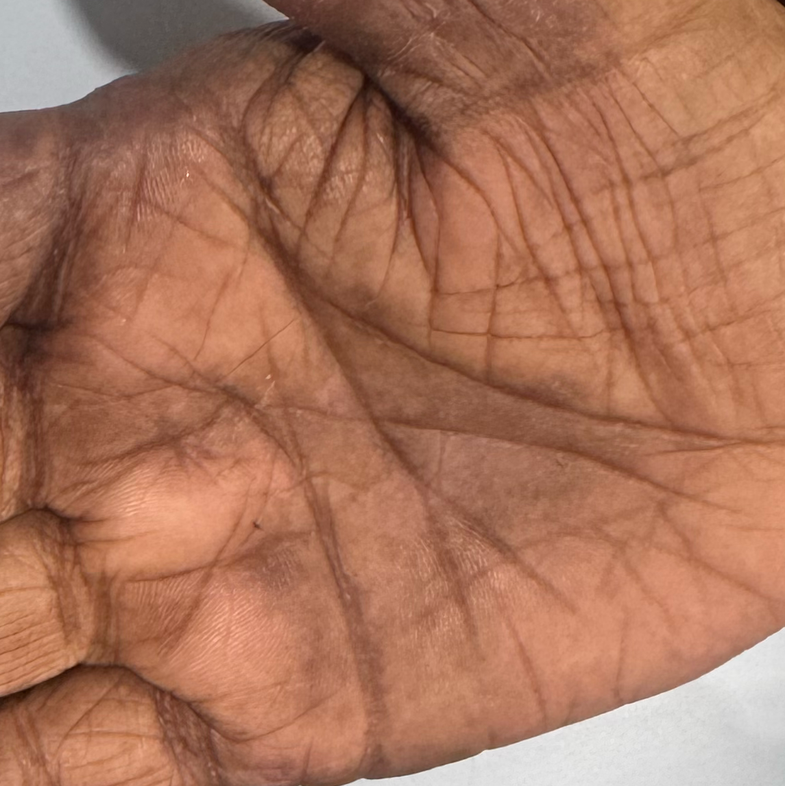 Vibha skin
