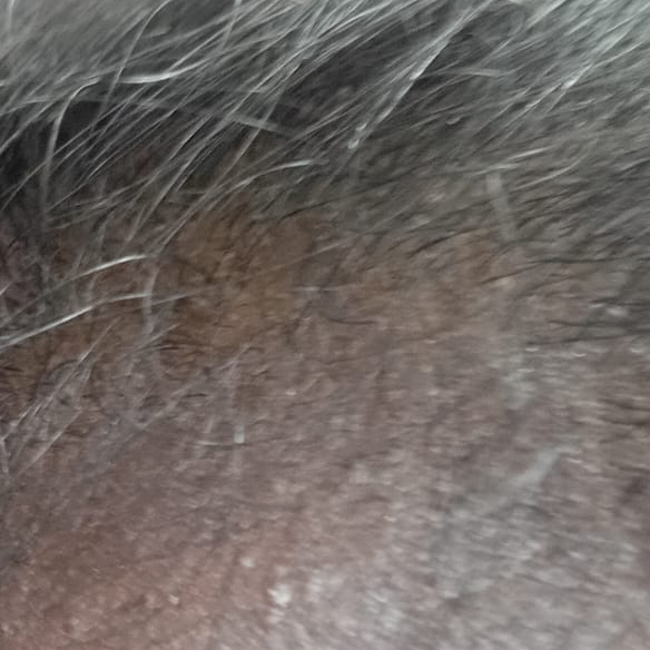 Vibha skin