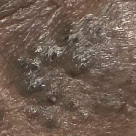 Vibha skin