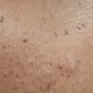 Vibha skin