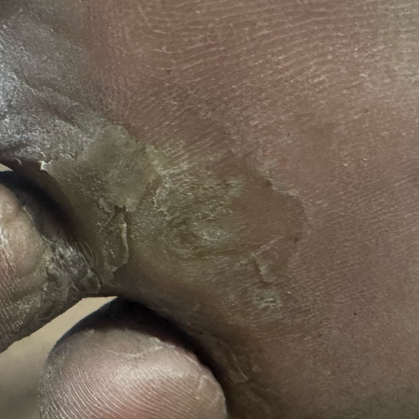 Vibha skin