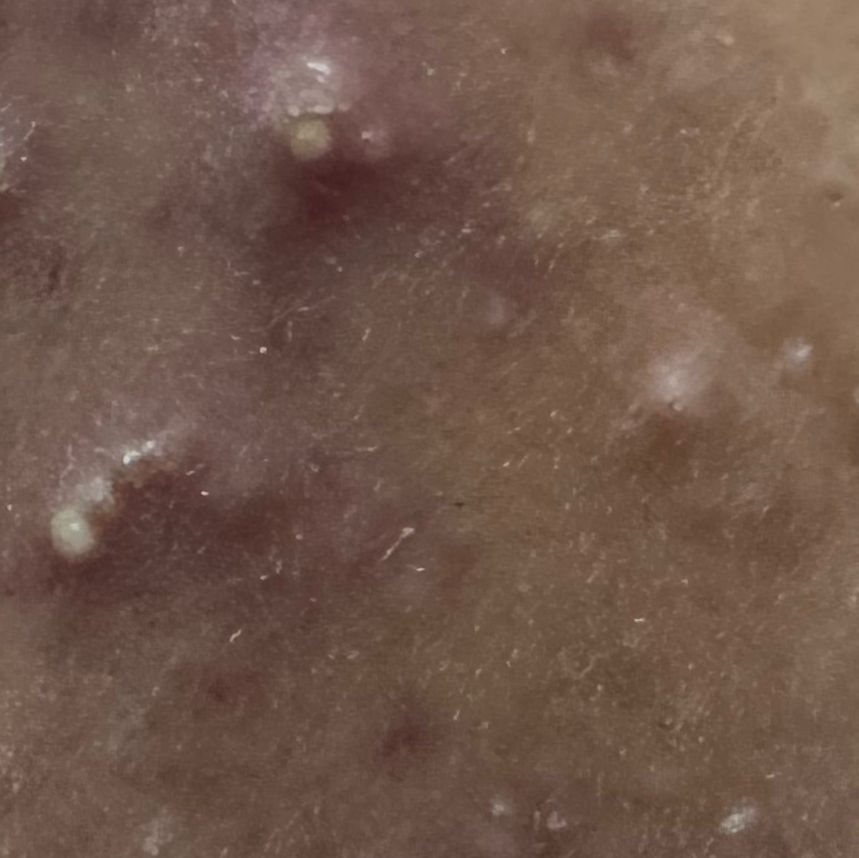 Vibha skin