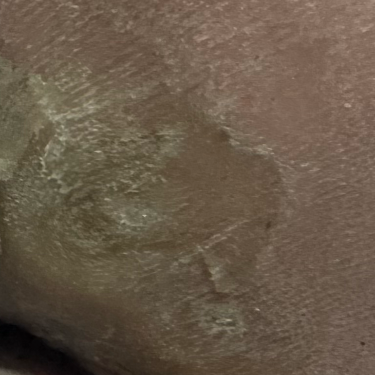 Vibha skin