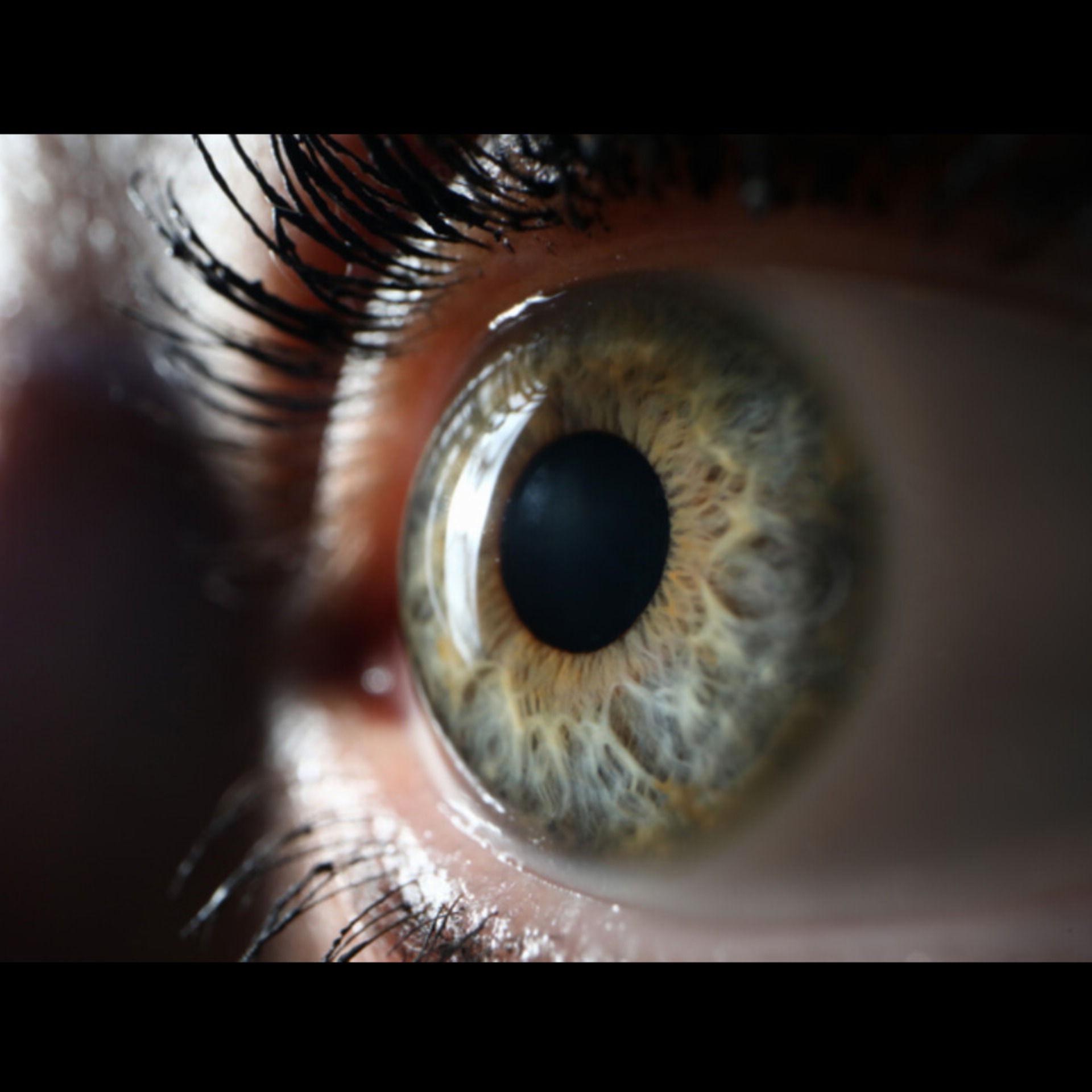 Eye Doctor Near Me In Salem  main image