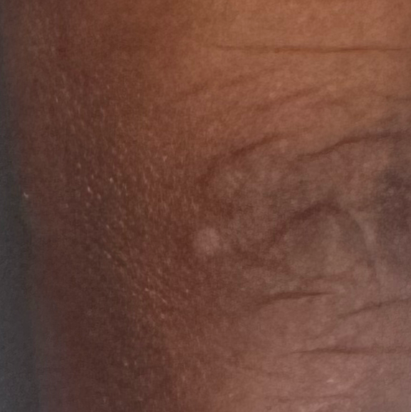 Vibha skin