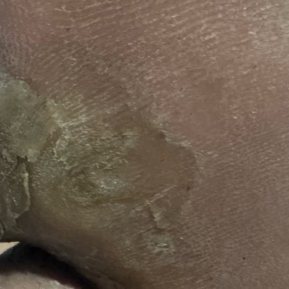 Vibha skin