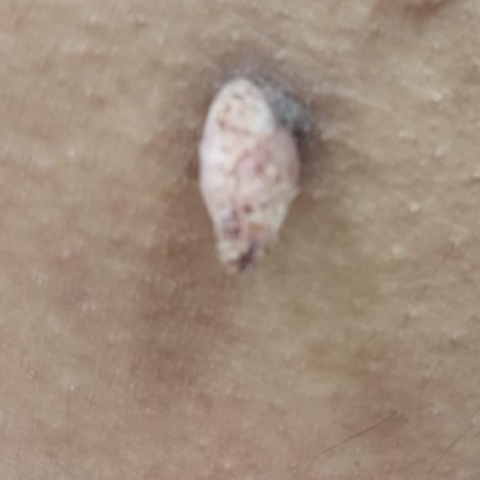 Vibha skin