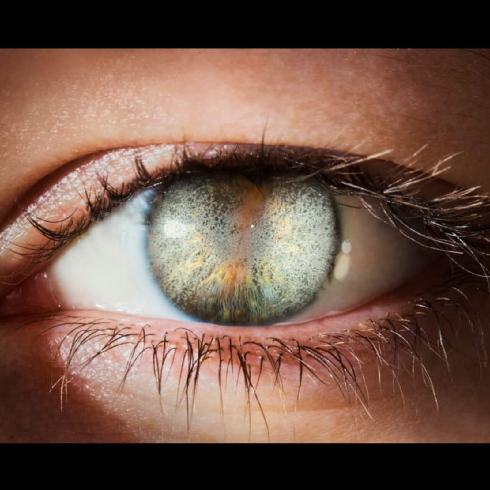 Best Eye Doctor Near Me In Salem  main image
