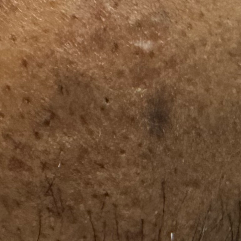 Vibha skin
