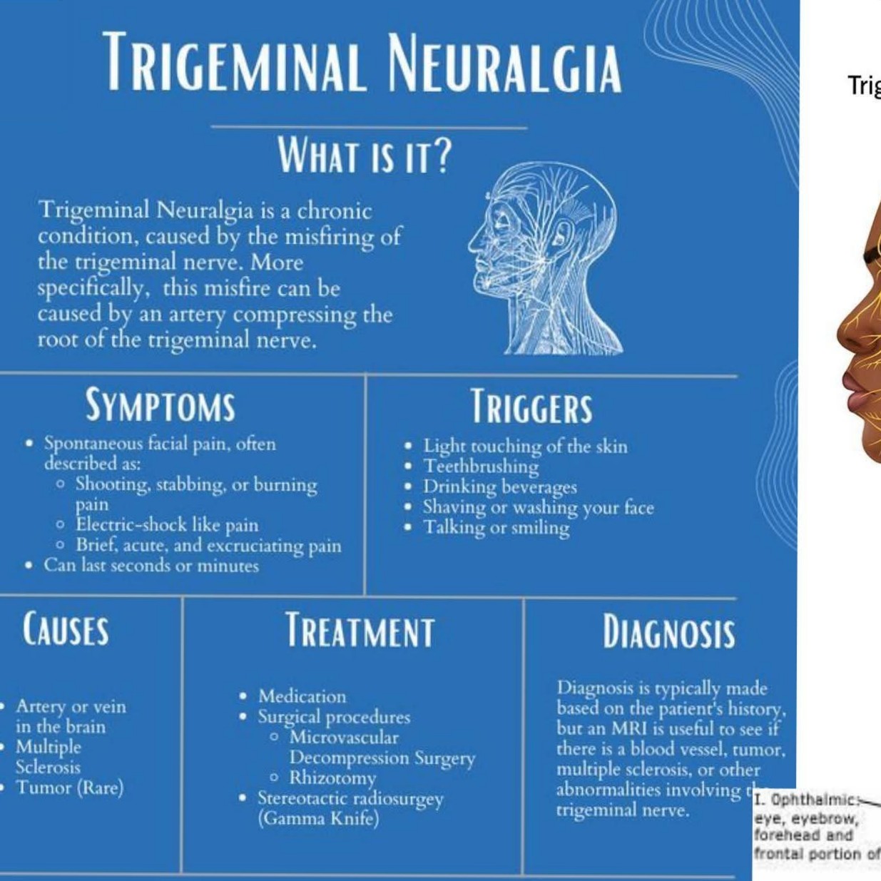TRIGEMINAL NEURALGIA treatment at Sunshine Super Speciality Physiotherapy Clinic main image