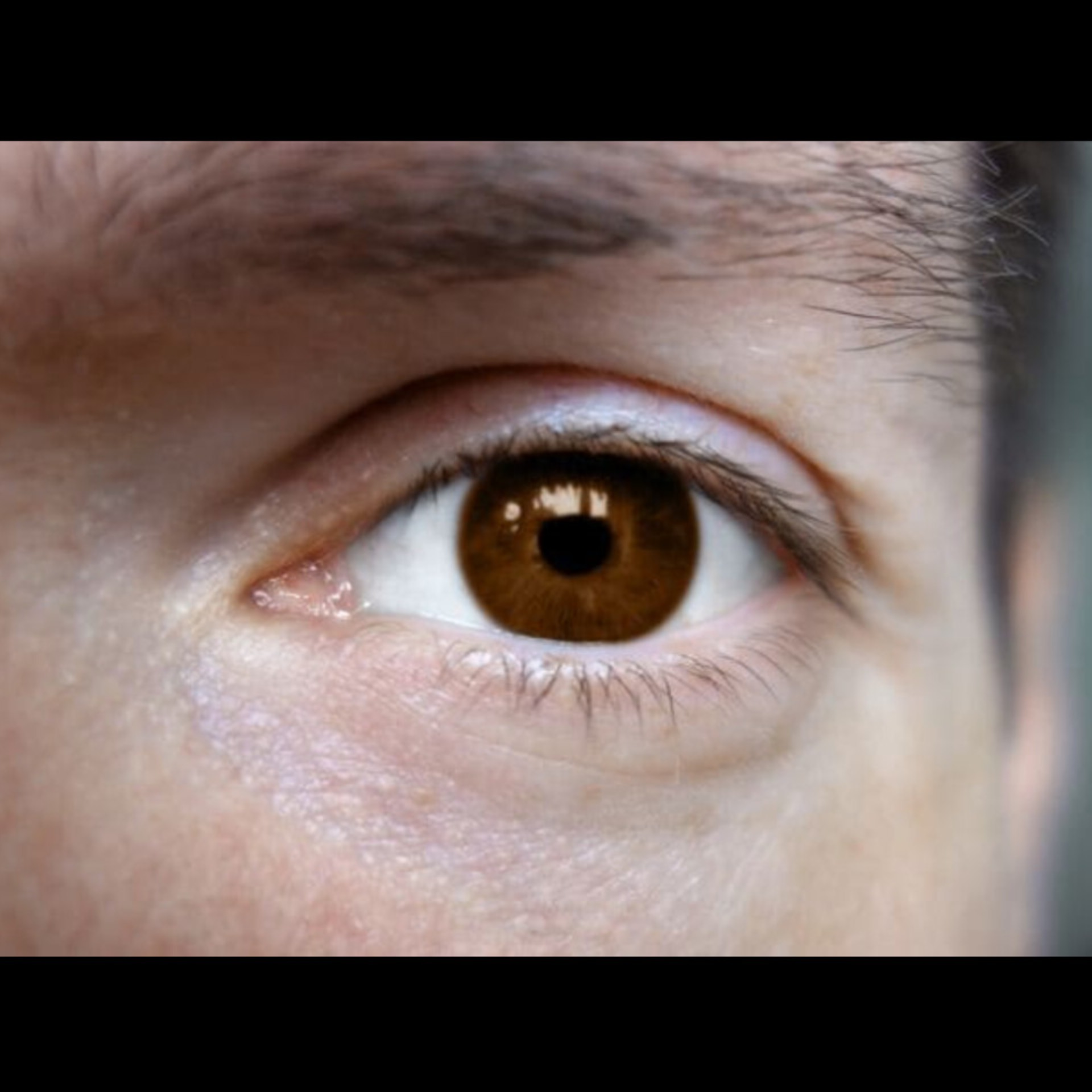 Eye Doctor Near Me In Salem  main image