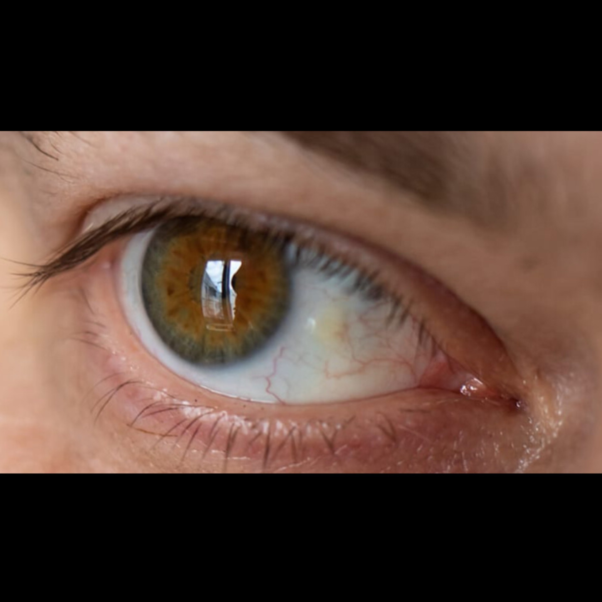Best Eye Doctor Near Me In Salem  main image