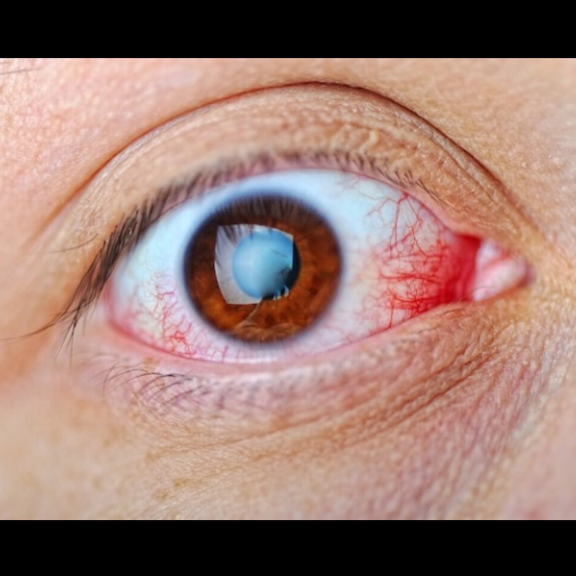 Best Eye Doctor Near Me In Salem  main image