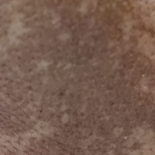 Vibha skin