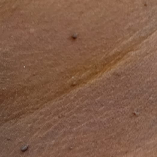 Vibha skin