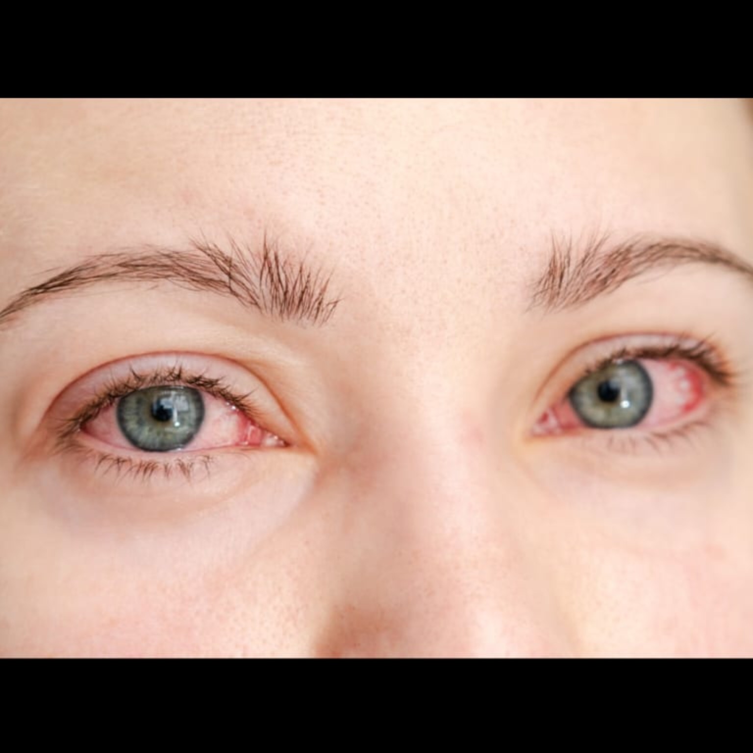 Best Eye Doctor Near Me In Salem  main image