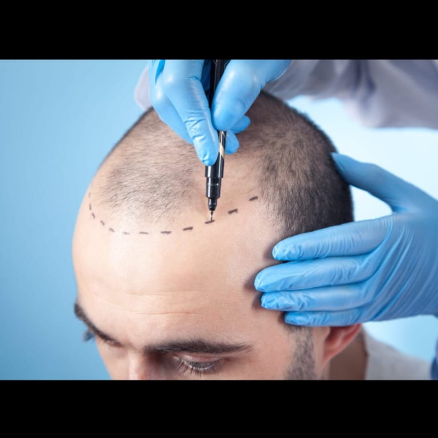 Hair Care Doctor Near Me In Salem  main image