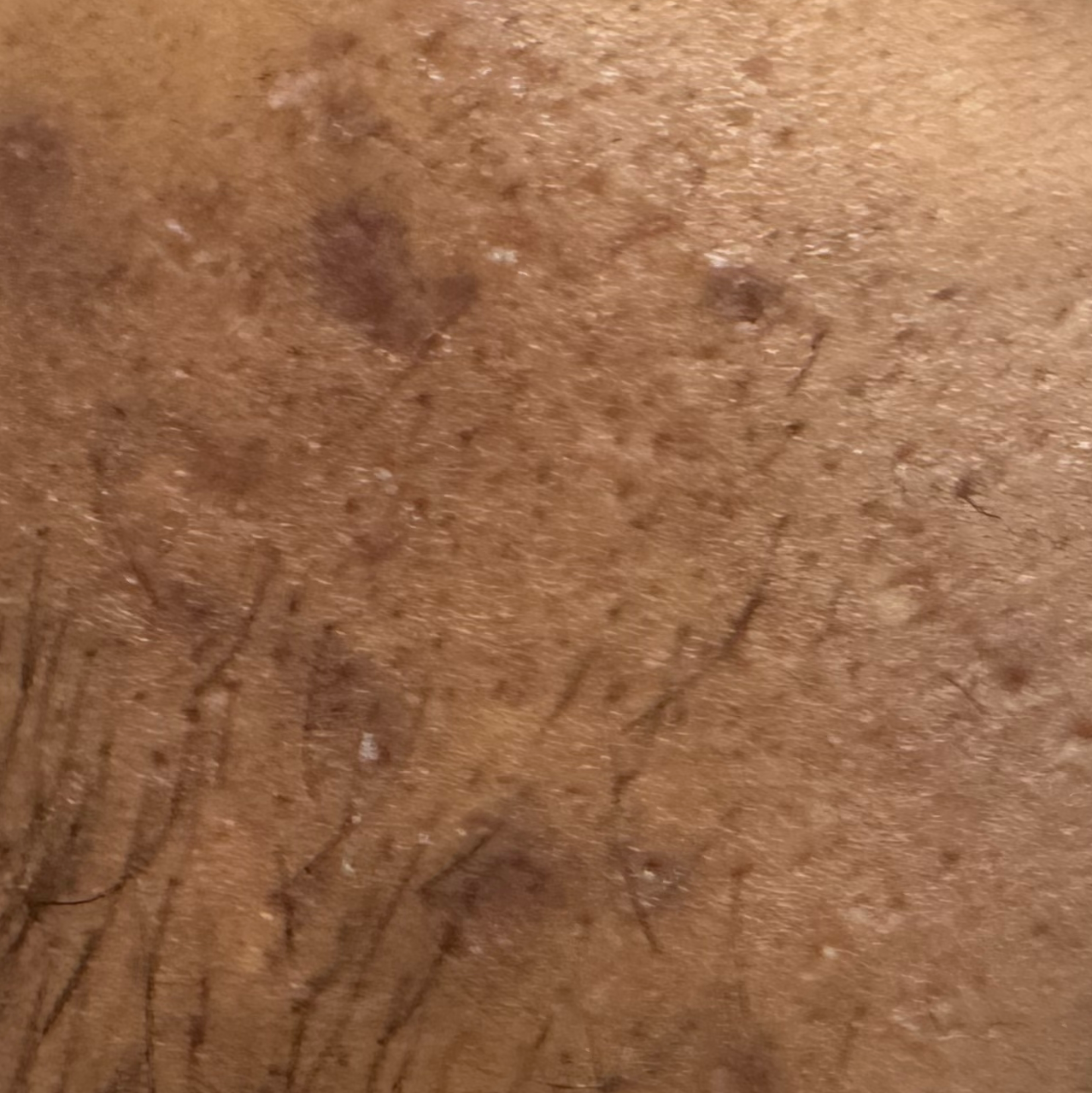Vibha skin