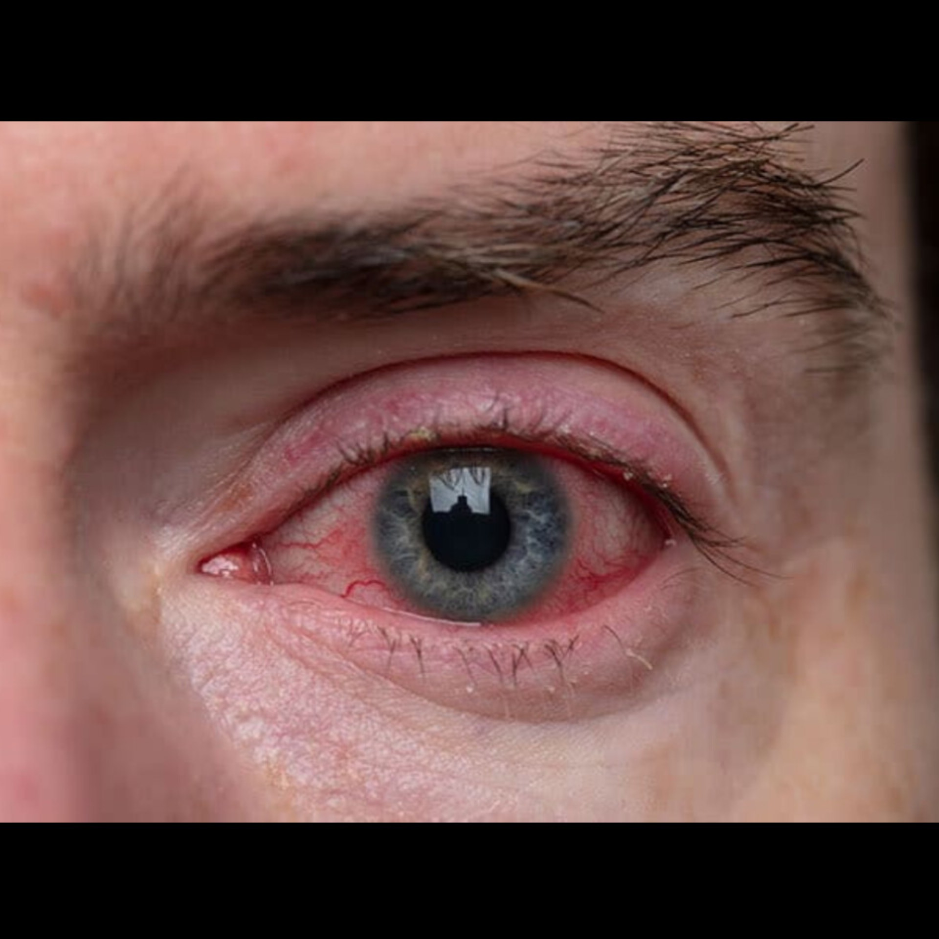 Eye Doctor Near Me In Salem  main image