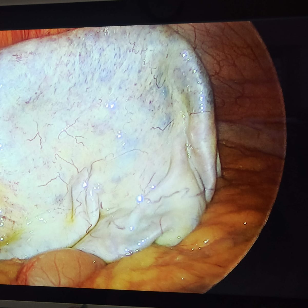 Laparoscopic Surgery main image