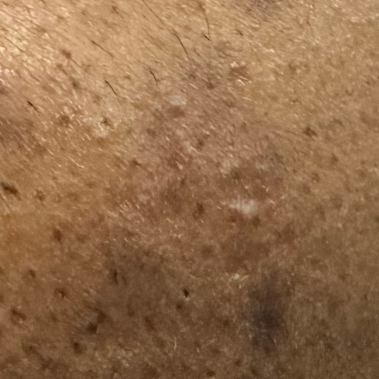 Vibha skin