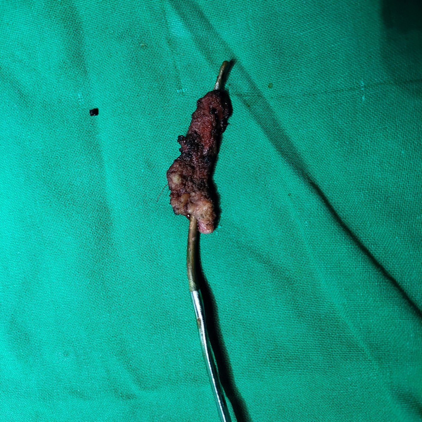 ProctoCare main image