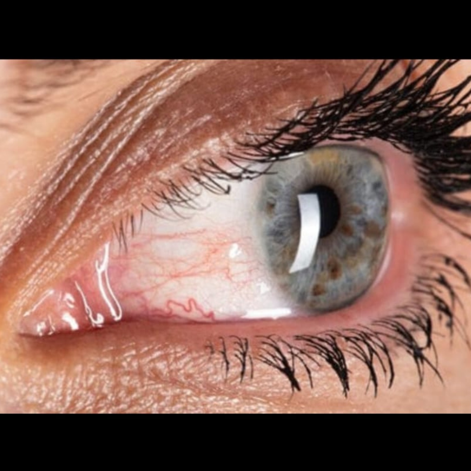 Eye Doctor Near Me In Salem Seelanaickenpatti  main image