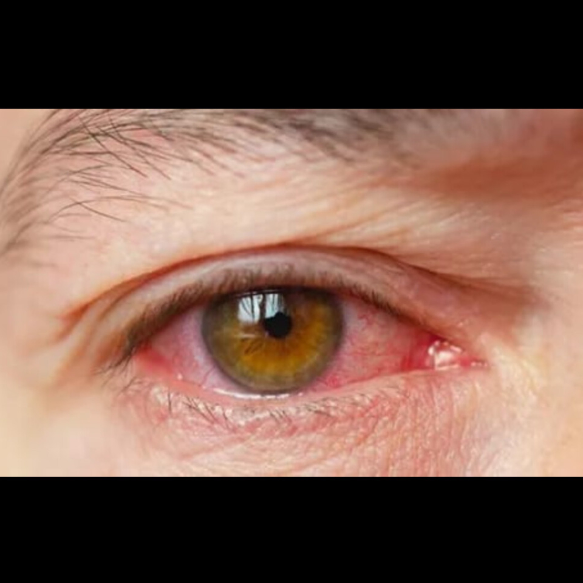 Best Eye Doctor Near Me In Salem  main image