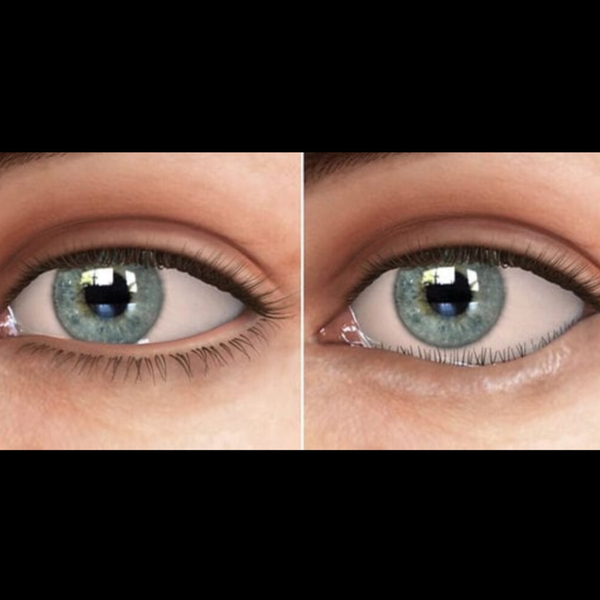 Best Eye Doctor Near Me In Salem  main image