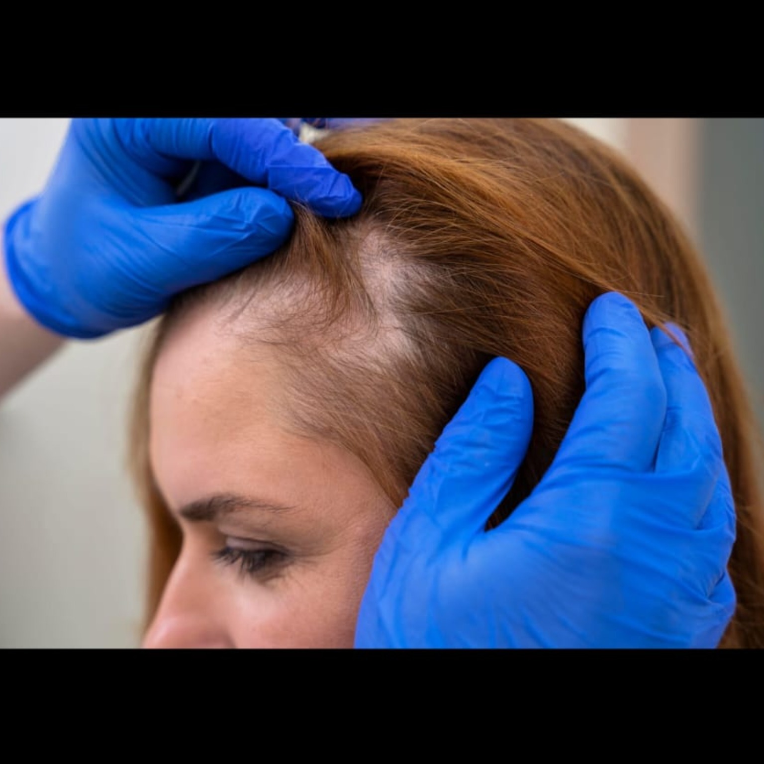 Dermatology Near Me In Salem  main image