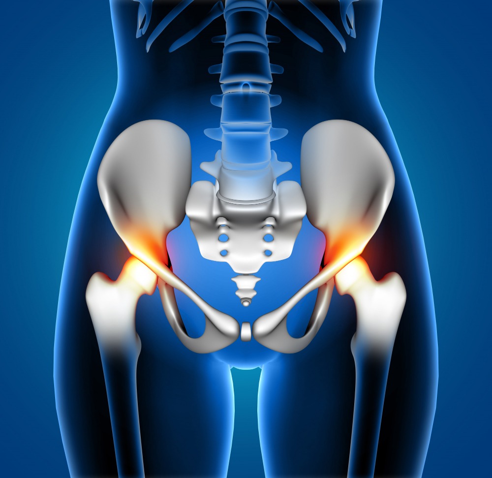 Total Hip Replacement in Chennai – Restoring Freedom of Movement main image